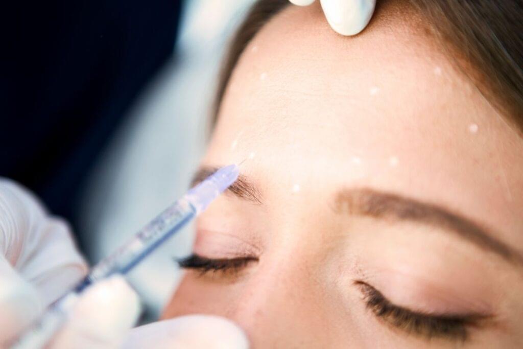 Botox Eyebrow Lift for Hooded Eyes in Huntngton Beach